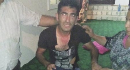 “Qara maskalı şəxs mənə iynə vurmağa çalışanda qışqırdım, qaçdı” “Qara maskalı şəxs mənə iynə vurmağa çalışanda qışqırdım, qaçdı”