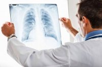 Koronavirus pandemiyası vərəmlə mübarizəni çətinləşdirir - AÇIQLAMA