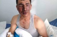 Sahil Babayevin nazirliyi daha bir Qazini intihar həddinə çatdırıb - "İntihar etmək istəyirəm... Bezmişəm artıq!"