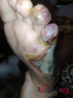 "HB Güvən" klinikasının professoru qazinin ayağını görün nə hala saldı - DƏHŞƏTLİ FOTOLAR "HB Güvən" klinikasının professoru qazinin ayağını görün nə hala saldı - DƏHŞƏTLİ FOTOLAR