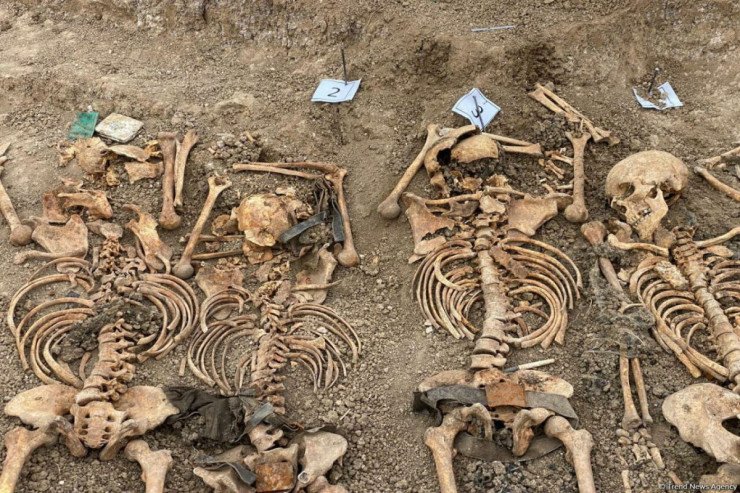 Ağdamda 30 il əvvəl öldürülüb basdırılanların sümükləri TAPILDI Ağdamda 30 il əvvəl öldürülüb basdırılanların sümükləri TAPILDI