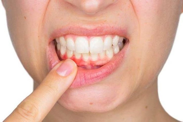 Stressdən uzaq durun! - Dişləriniz çürüyəcək... Stressdən uzaq durun! - Dişləriniz çürüyəcək...