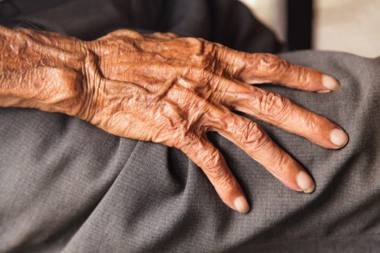 84 yaşlı xərçəng xəstəsi özünü asdı