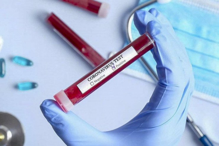 Çində koronavirusa günlük yoluxma rekordu - 37 milyon nəfər  