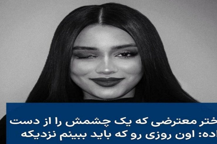 Molla rejimi gənc qızın gözünü çıxardı