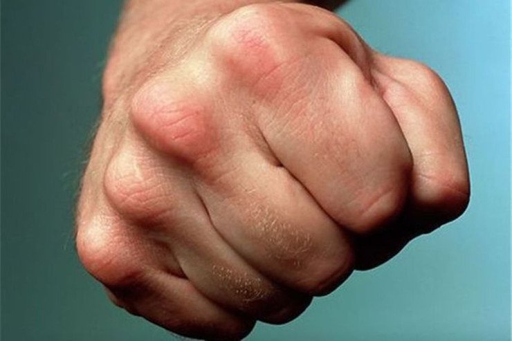 Gəncədə növbə üstündə DAVA: vurub gözünü çıxardı