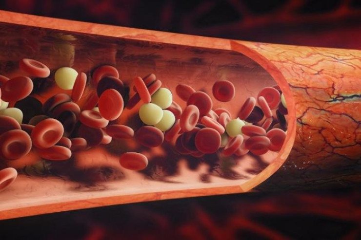 Qandakı hemoqlobini necə tez artırmaq olar? Qandakı hemoqlobini necə tez artırmaq olar?