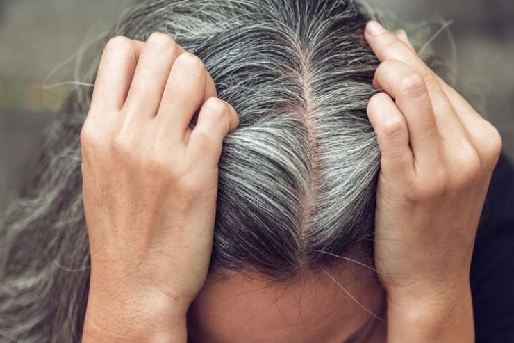 Saçların ağarmasını necə dayandırmaq olar? Saçların ağarmasını necə dayandırmaq olar?
