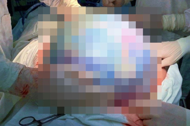 Coli və Pittin işi - məhkəmə aktyora qarşı sərt qərar çıxardı